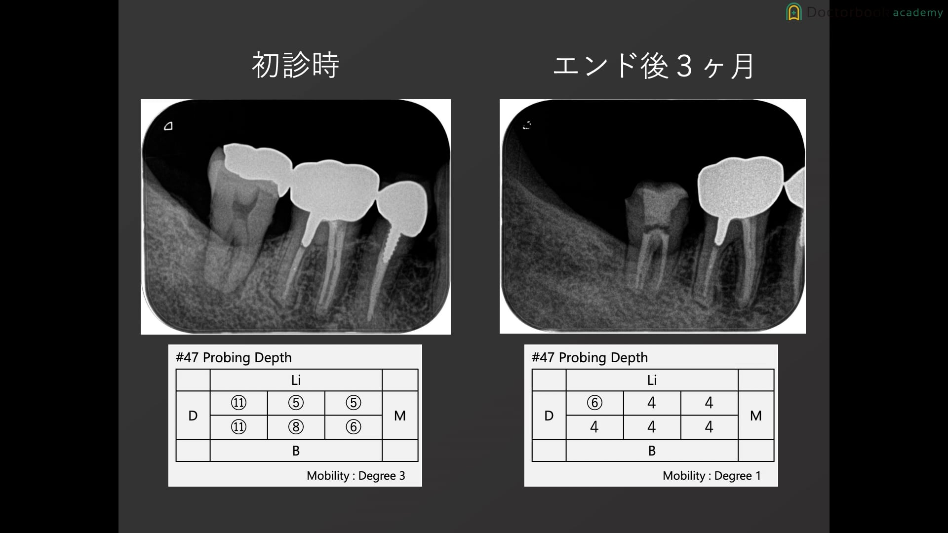 #2 基礎編 後半 / 髙井俊輔先生