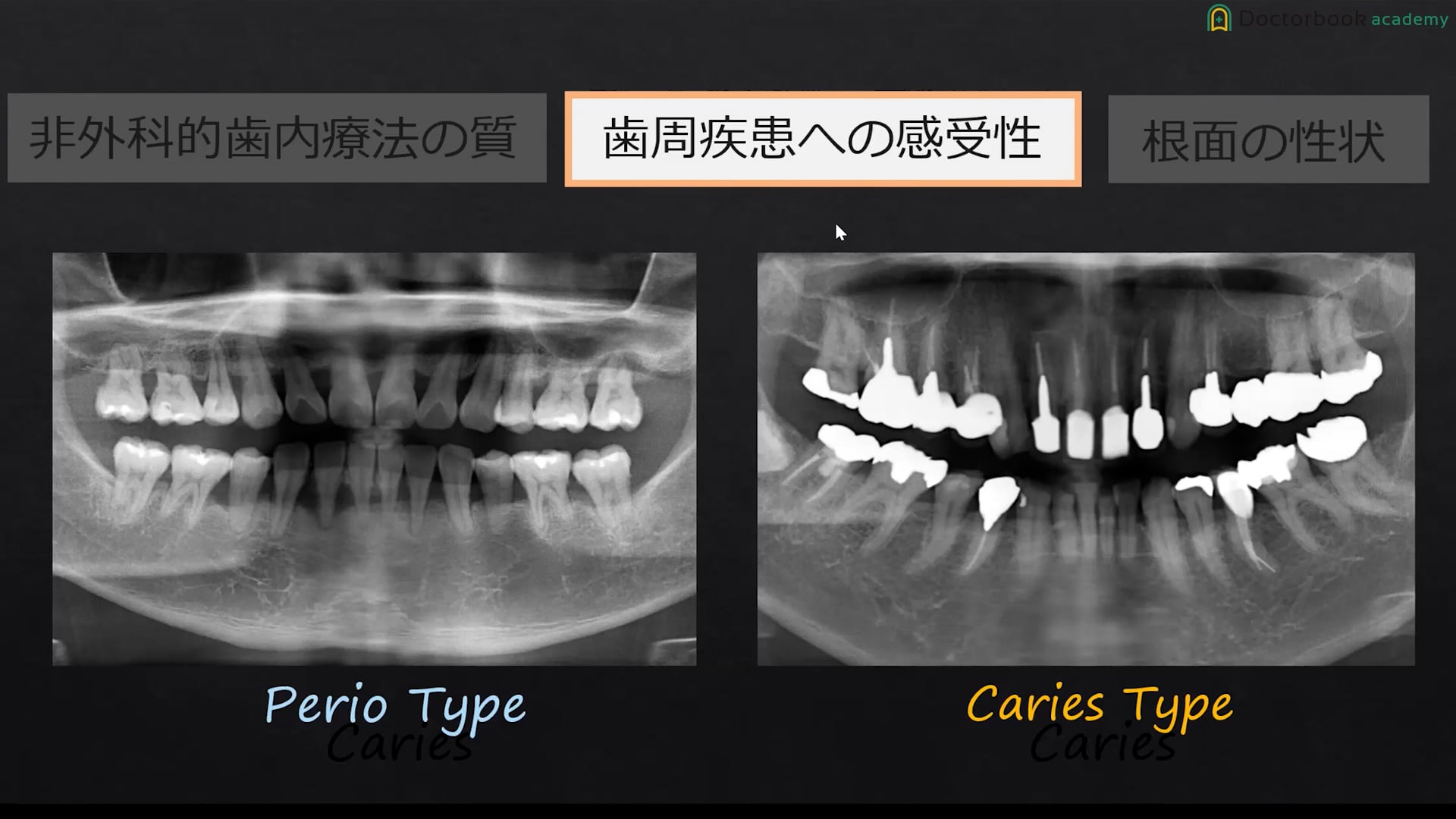 #3 応用編 前半 / 齋藤伸和先生