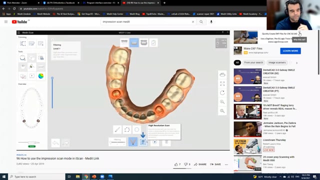 Medit i700 & Medit Link: The key to  Digital Dentistry.