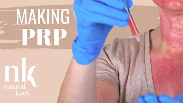Making PRP at Home & Microneedling video