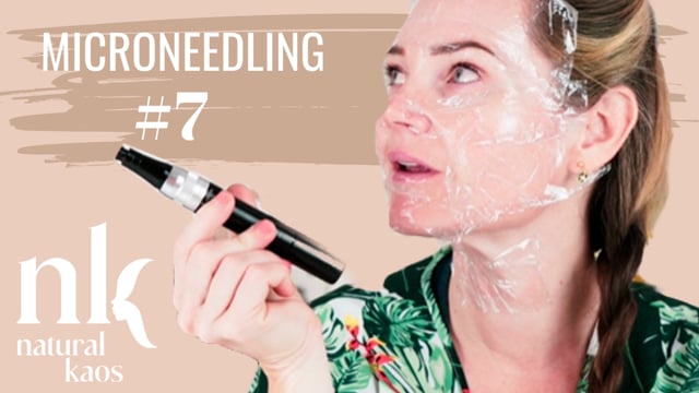 MICRONEEDLING Session #7 Natural Kaos Skincare