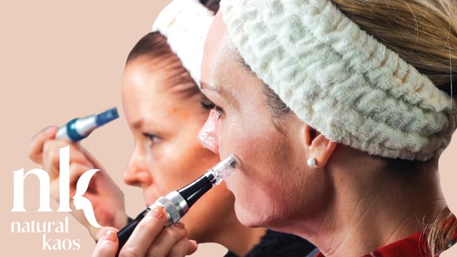 Tandem MICRONEEDLING Tori's First Time, Natural Kaos Skincare