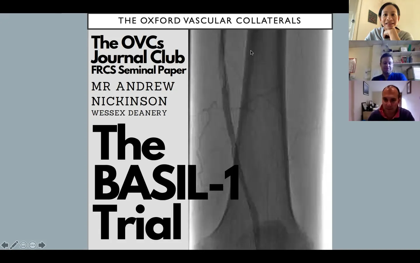 The BASIL 1 Trial presented by Mr Andrew Nickinson