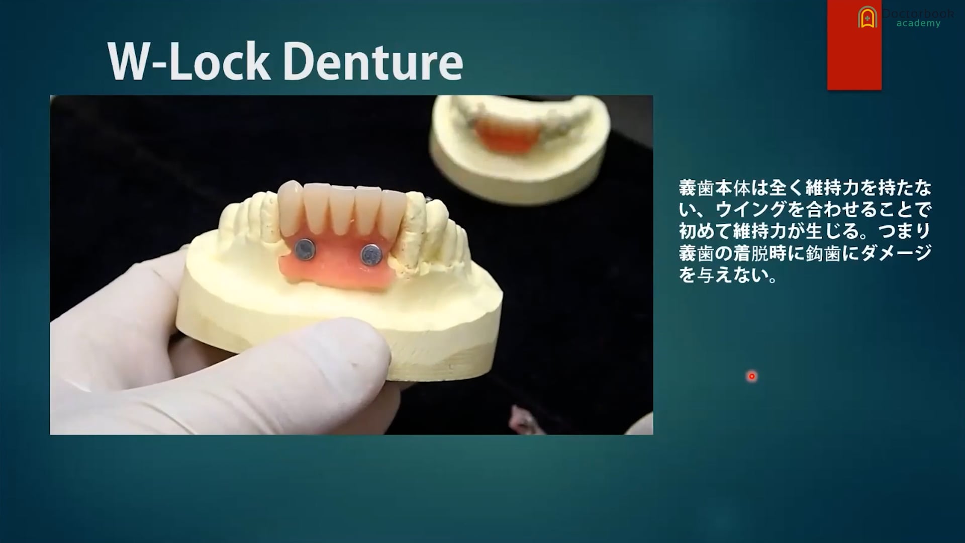 歯科技工パーシャルデンチャー患者説明用 | www.reelemin242.com