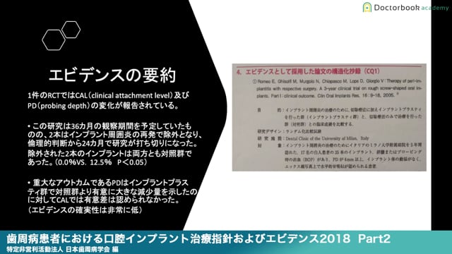 『歯周病患者における口腔インプラント治療指針およびエビデンス2018』解説 Part2