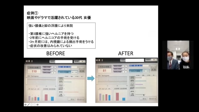 脈波から体調・体質を読み取る〜脈派測定で何がわかるか〜 vol.3