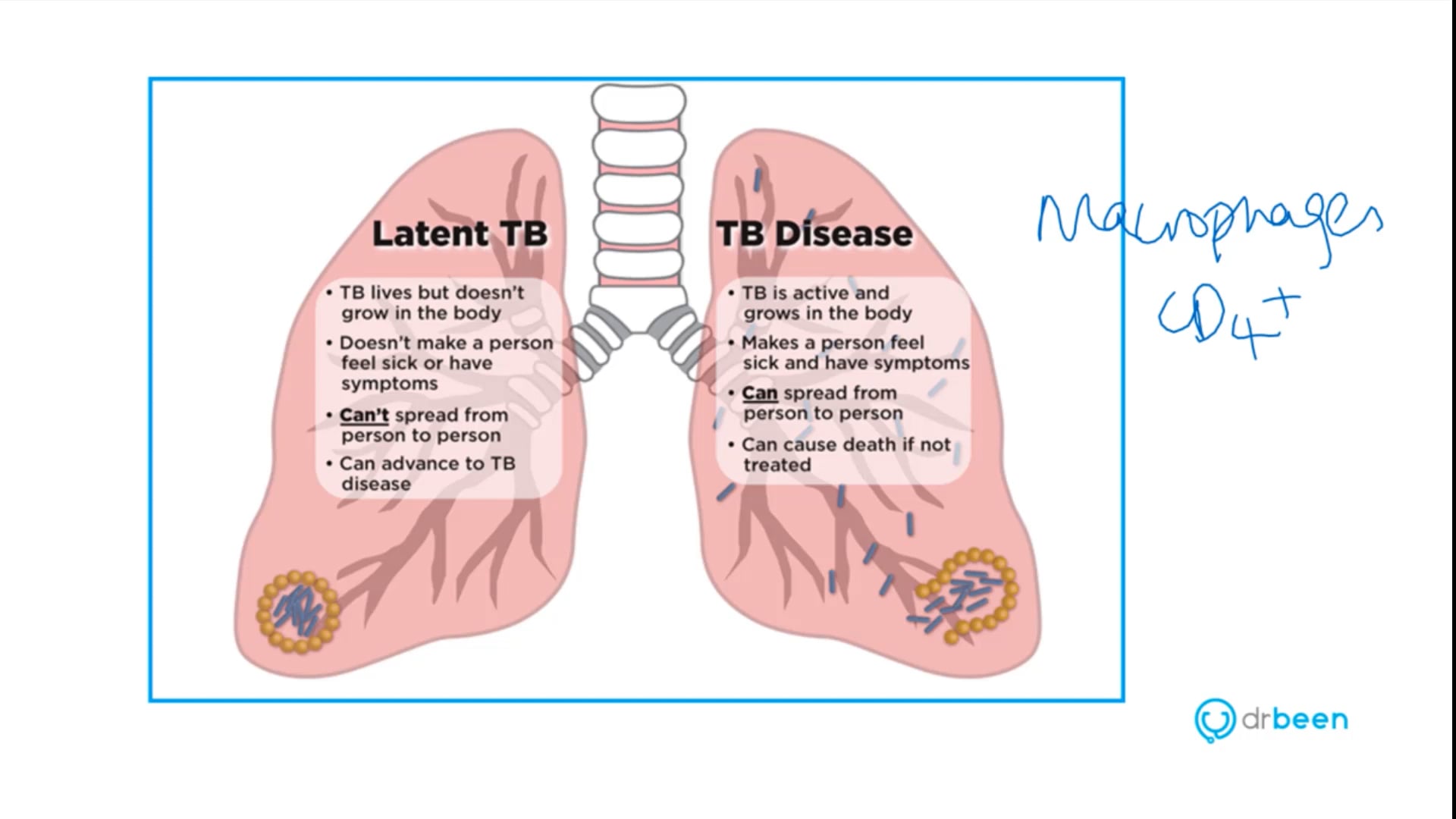 Tuberculosis (Dr. Bhatti)
