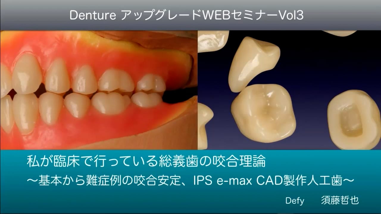 Vol.3 私が臨床で行なっている総義歯の咬合理論 〜基本から難症例の咬合安定、 IPS e.max CAD製作人工歯〜