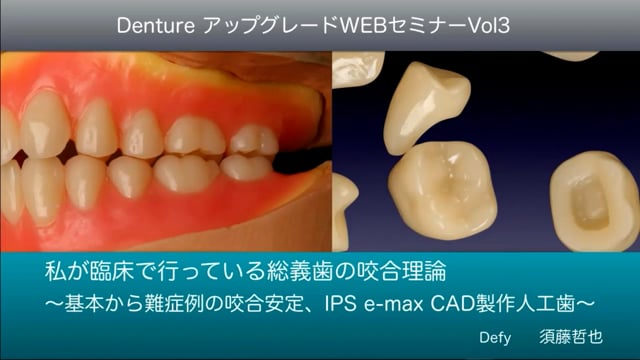 総義歯臨床の押さえどころ - 本