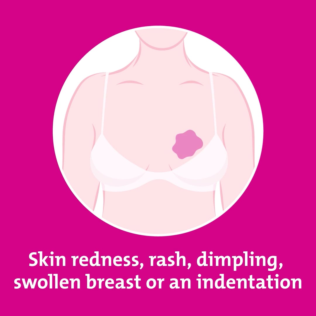 Breast health self check - Signs and symptoms to watch for - Redness on  Vimeo