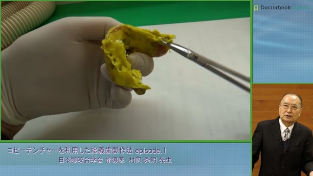 コピーデンチャーを利用した総義歯製作法 episode.1【ご好評