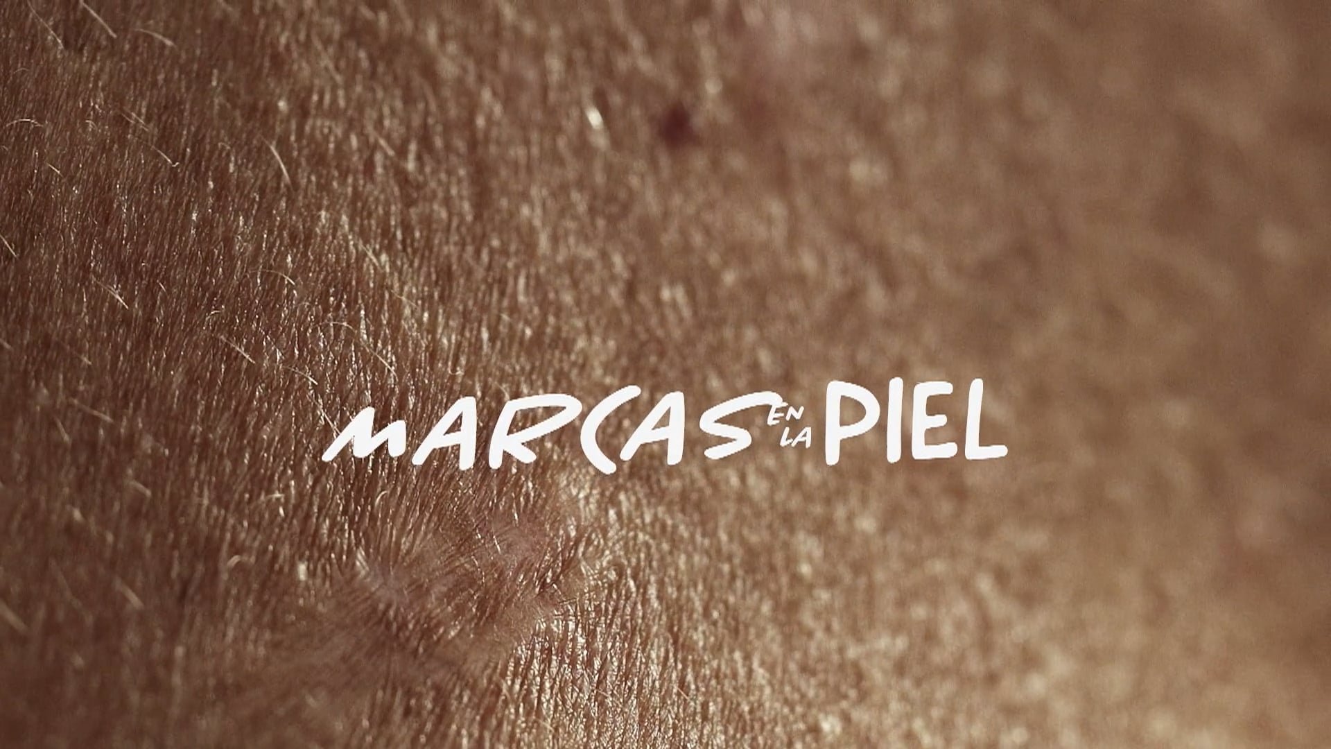 MARCAS EN LA PIEL - TRAILER