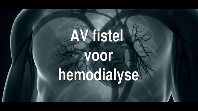 AV fistel voor hemodialyse on Vimeo