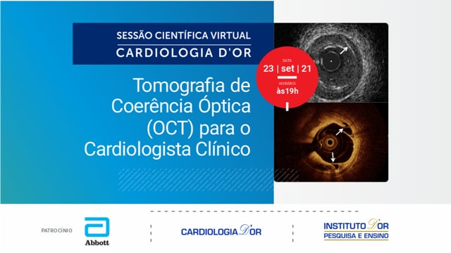 Tomografia de Coerência Óptica (OCT) para o Cardiologista Clínico