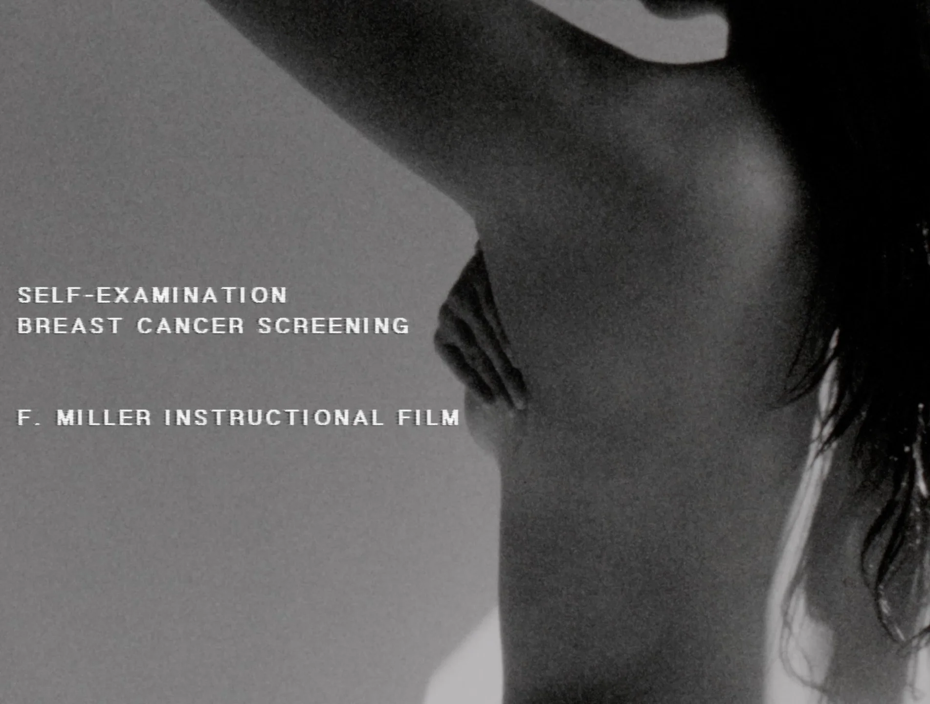Self Examination - Breast Cancer Screening, an F. Miller