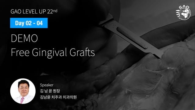 [LEVEL UP 22기 2회차] 06 DEMO - Free Gingival Grafts - 김남윤 원장