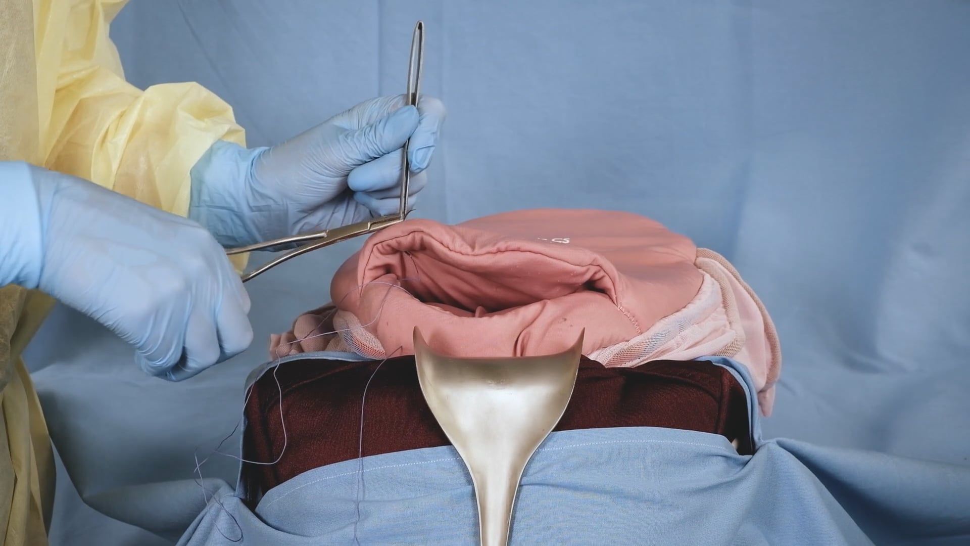 MamaBirthie CS - B-Lynch Suture On Vimeo