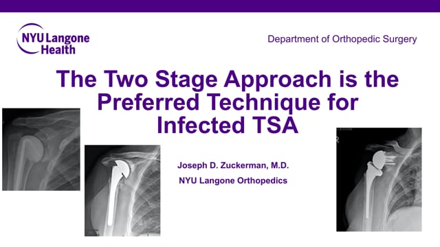 The Two Stage Approach is the Preferred Technique for Infected TSA