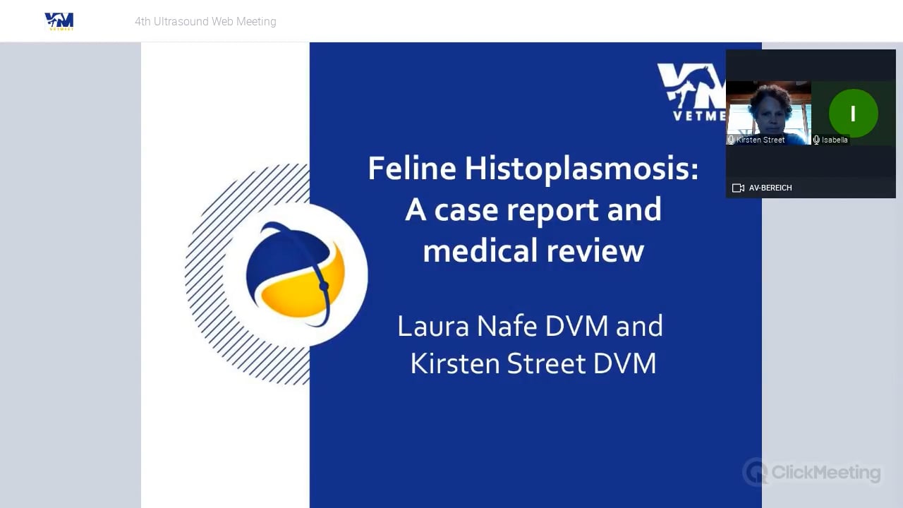 Ultrasound features of Histoplasmosis