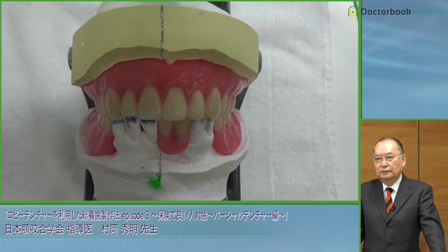 コピーデンチャーを利用した総義歯製作法 Episode.3 保険で良い