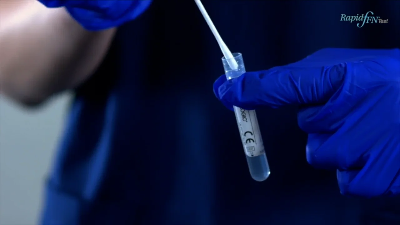 Rapid fFN Testing – Collection and analysis on Vimeo