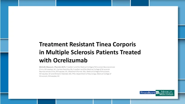 Treatment-Resistant Tinea Corporis