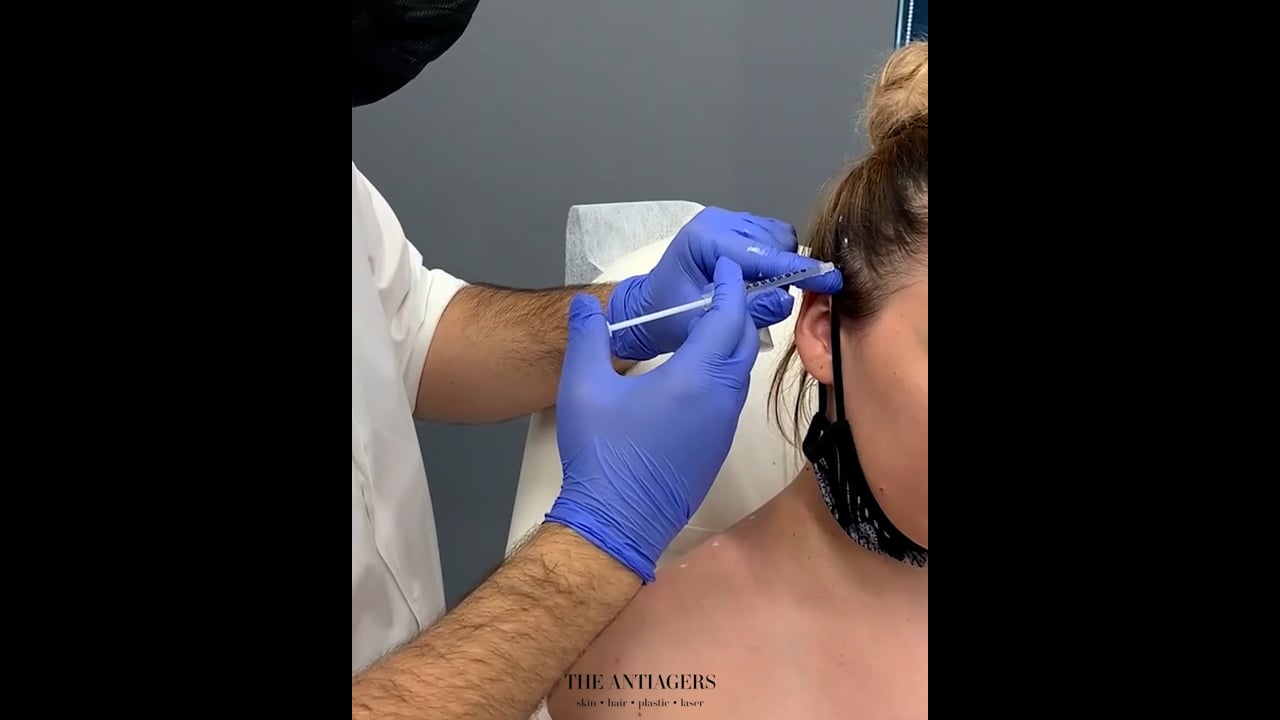 Botox για ημικρανίες