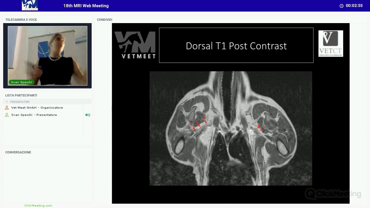 Brachial and lumbosacral plexus - Part 2 (MRI)