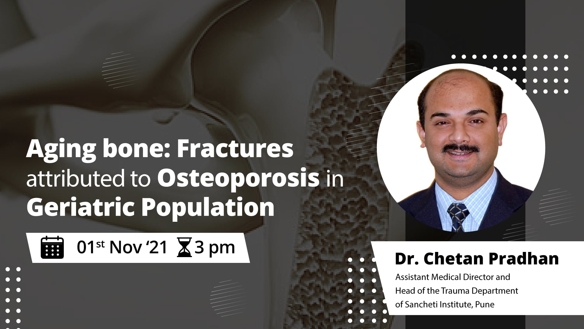 Aging bone: Fractures Attributed to Osteoporosis in Geriatric Population