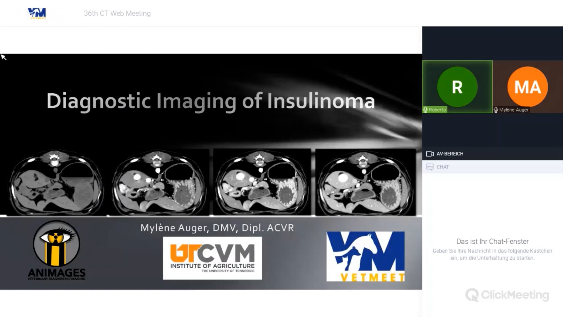Imaging of insulinoma: protocols, anatomy and clinical applications