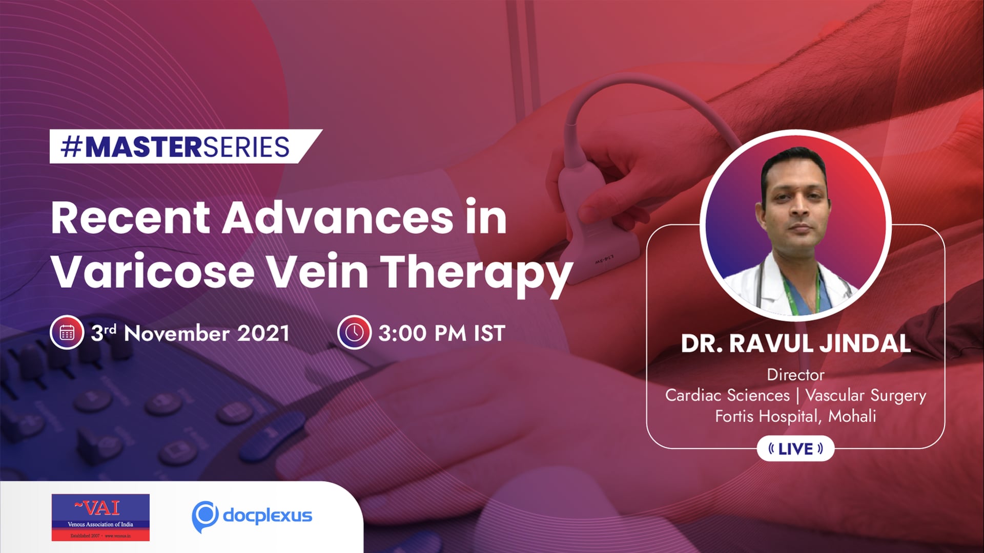 Recent Advances in Varicose Vein Therapy