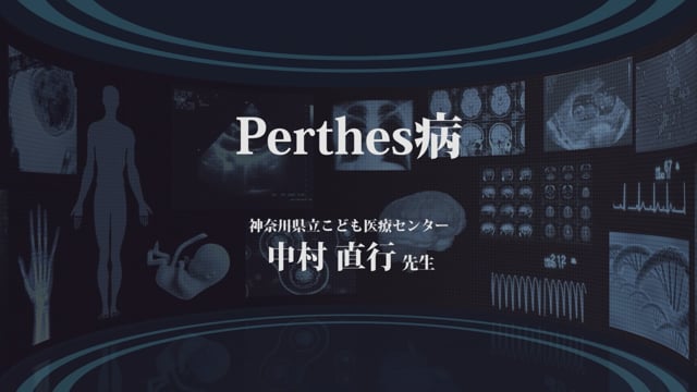 Perthes病 Part2
