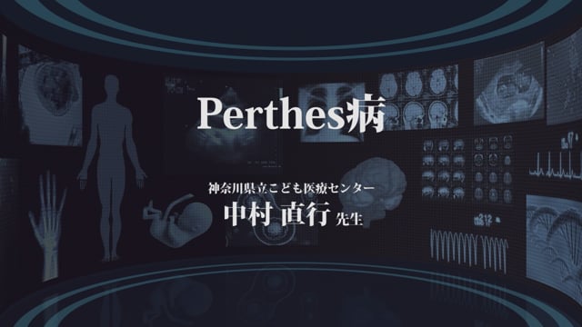 Perthes病 Part1