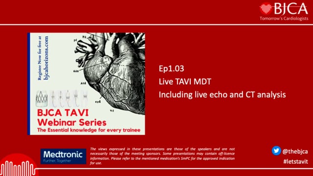TAVI SERIES: Live TAVI MDT - Ep 1.03