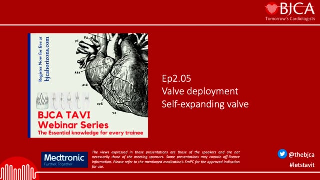 TAVI SERIES: Valve deployment – self-expanding valve – Ep 2.05