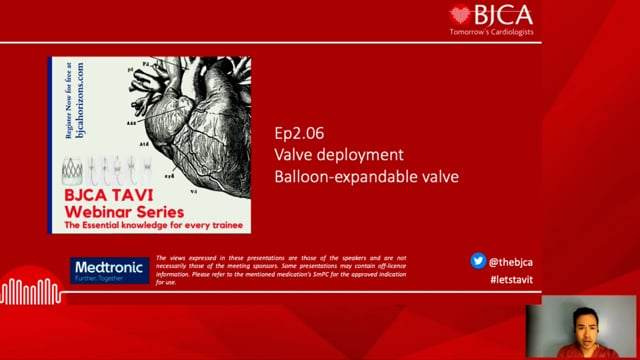 TAVI SERIES: Valve deployment - Balloon-expandable valve - Ep 2.06