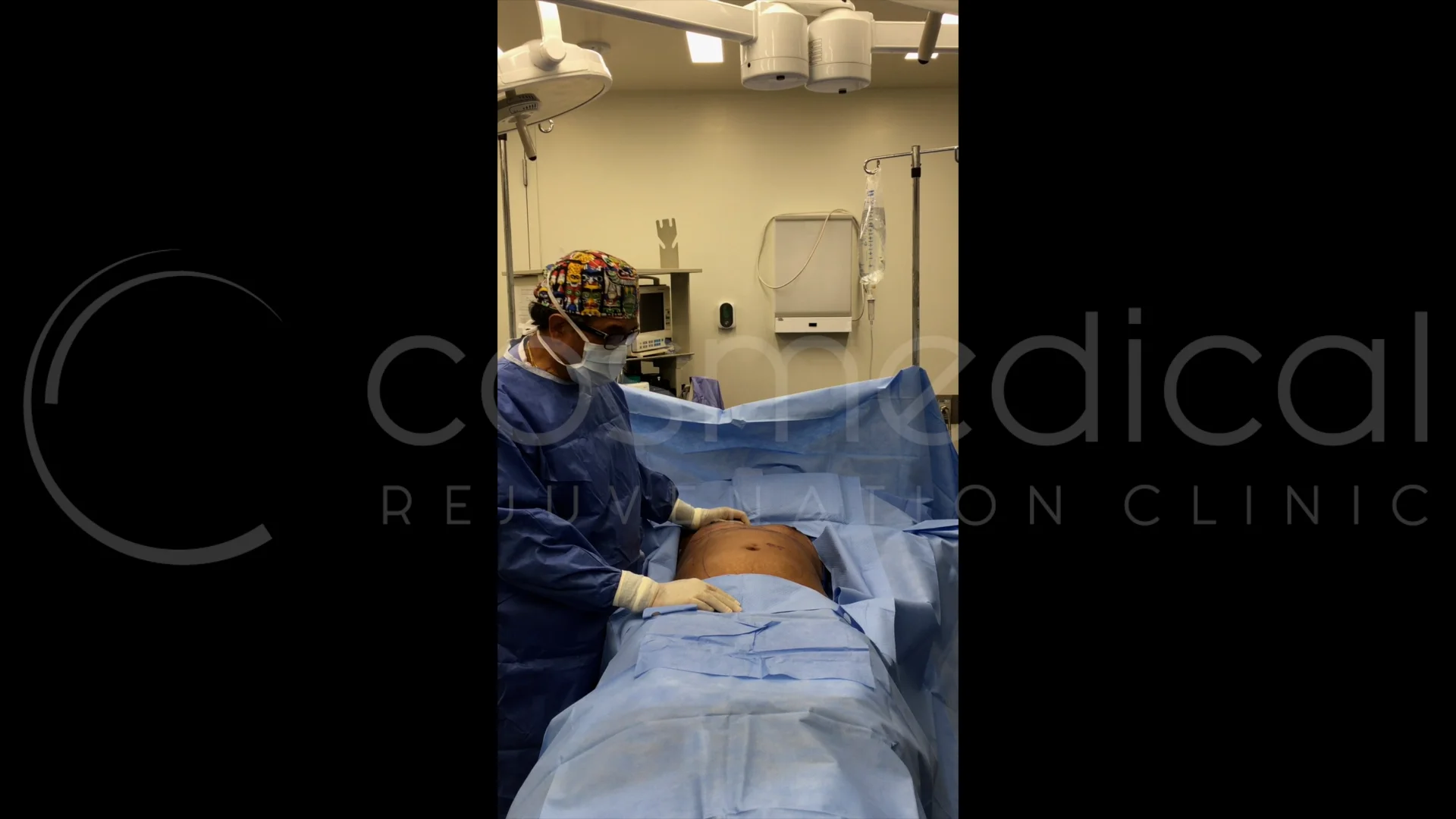 Breast Augmentation with Fat Transfer Toronto Cosmedical