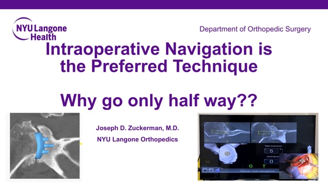 Intraoperative Navigation for Total Shoulder Arthroplasty