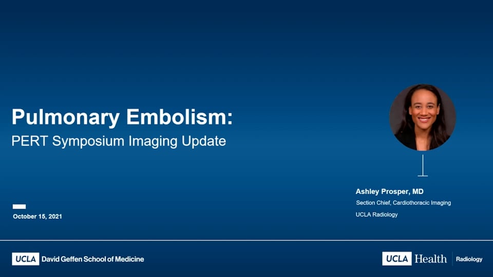 Update on Imaging in 2021 – CT and Beyond  </br>Ashley Prosper, MD 