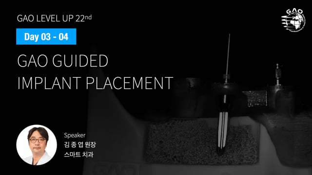 [LEVEL UP 22기 3회차] 12 GAO guided implant placement - 김종엽 원장