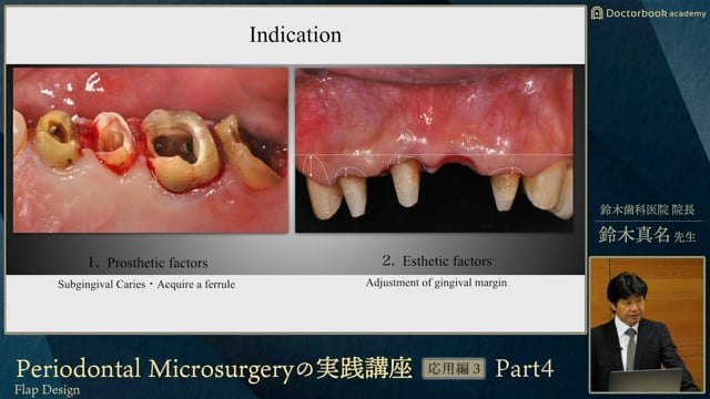 Periodontal Microsurgeryの実践講座 | Doctorbook academy (ドクター 