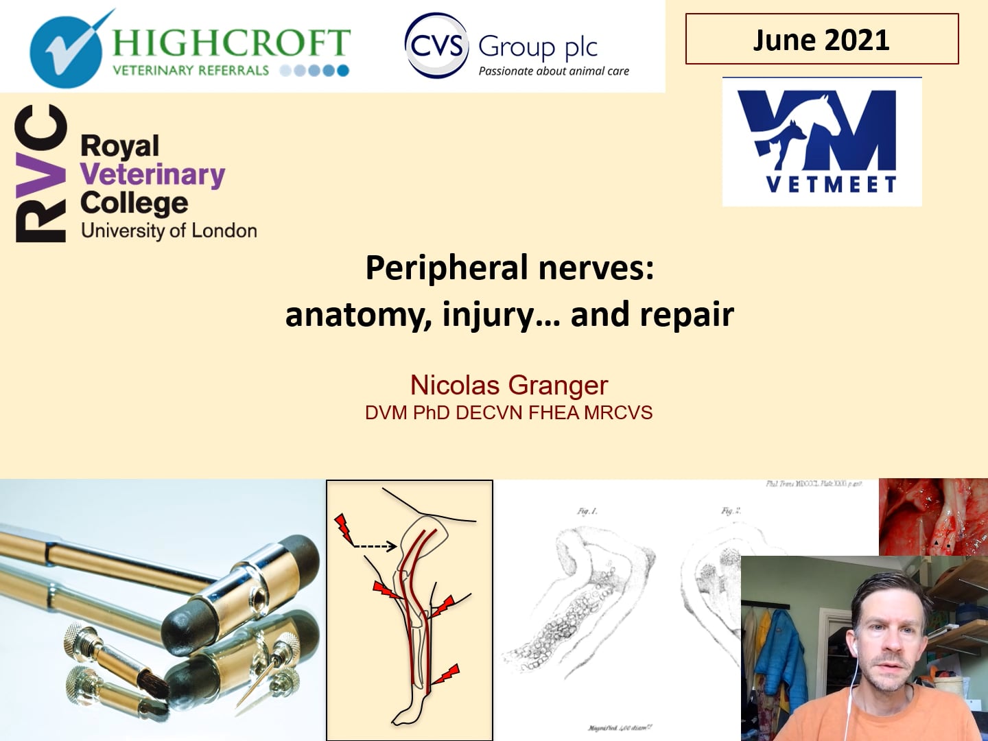 Peripheral nerves - anatomy, injury and repair