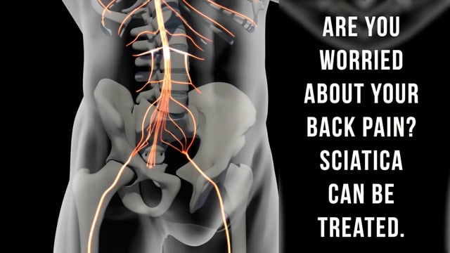 Sciatica Pain Treatment in Los Angeles and Santa Monica