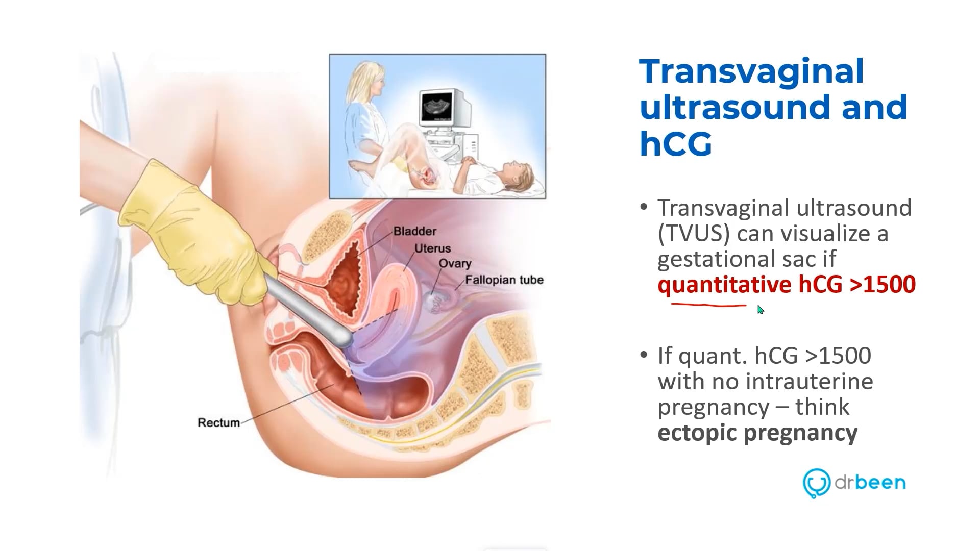 Diagnosing Pregnancy Part 2