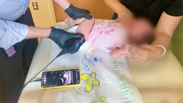 Portable Ultrasound Probe for Developmental Dysplasia of the Hip Screening