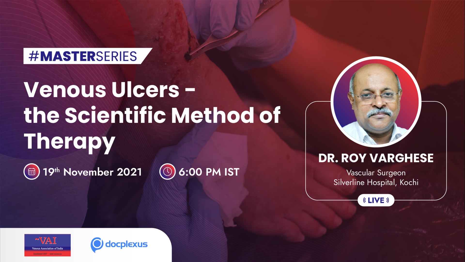 Venous Ulcers — The Scientific Method Of Therapy