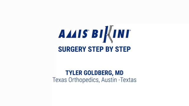 AMIS Bikini featuring an Amistem-P femoral stem and a Mpact DM acetabular cup – Dr Goldberg