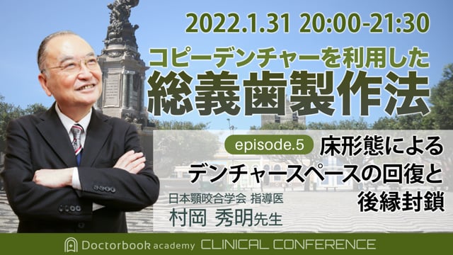 コピーデンチャーを利用した総義歯製作法episode.5〜床形態によるデンチャースペースの回復と後縁封鎖