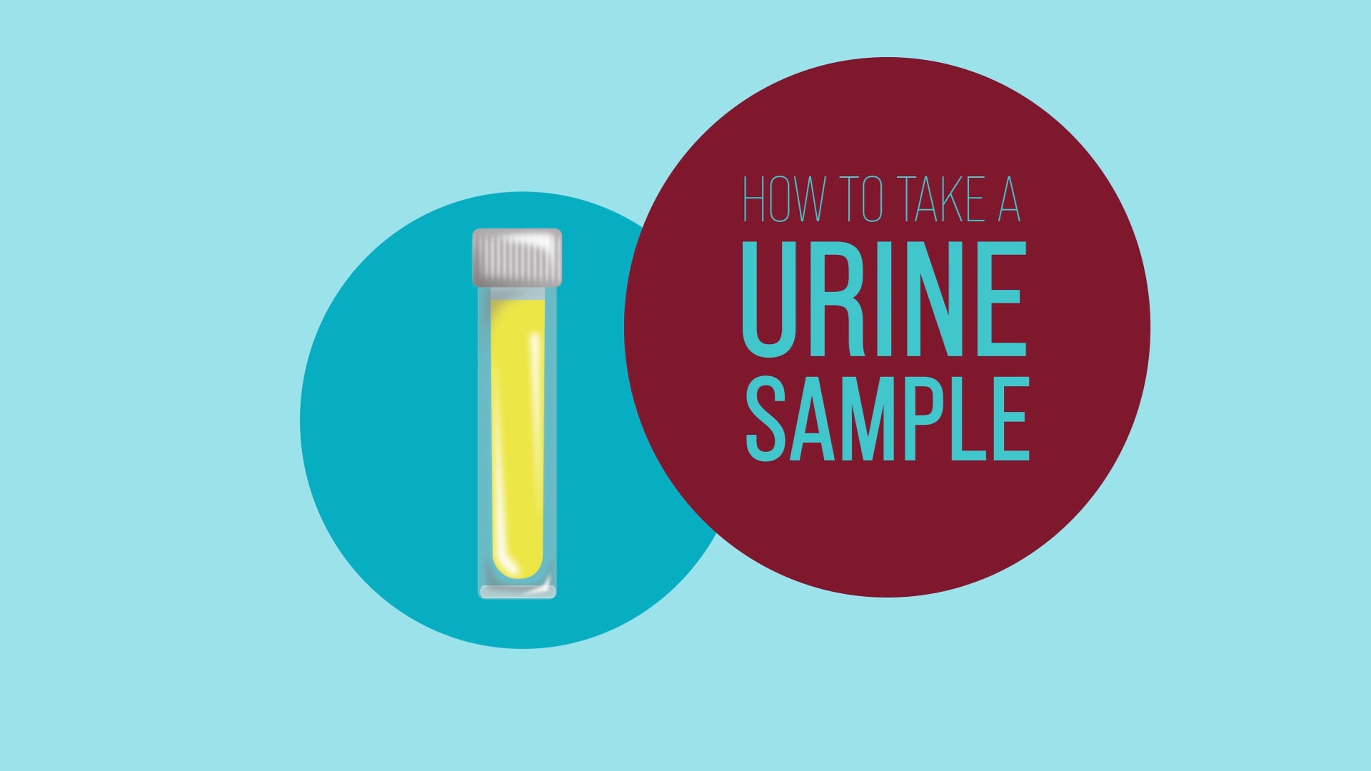 PREVENTX URINE SAMPLE