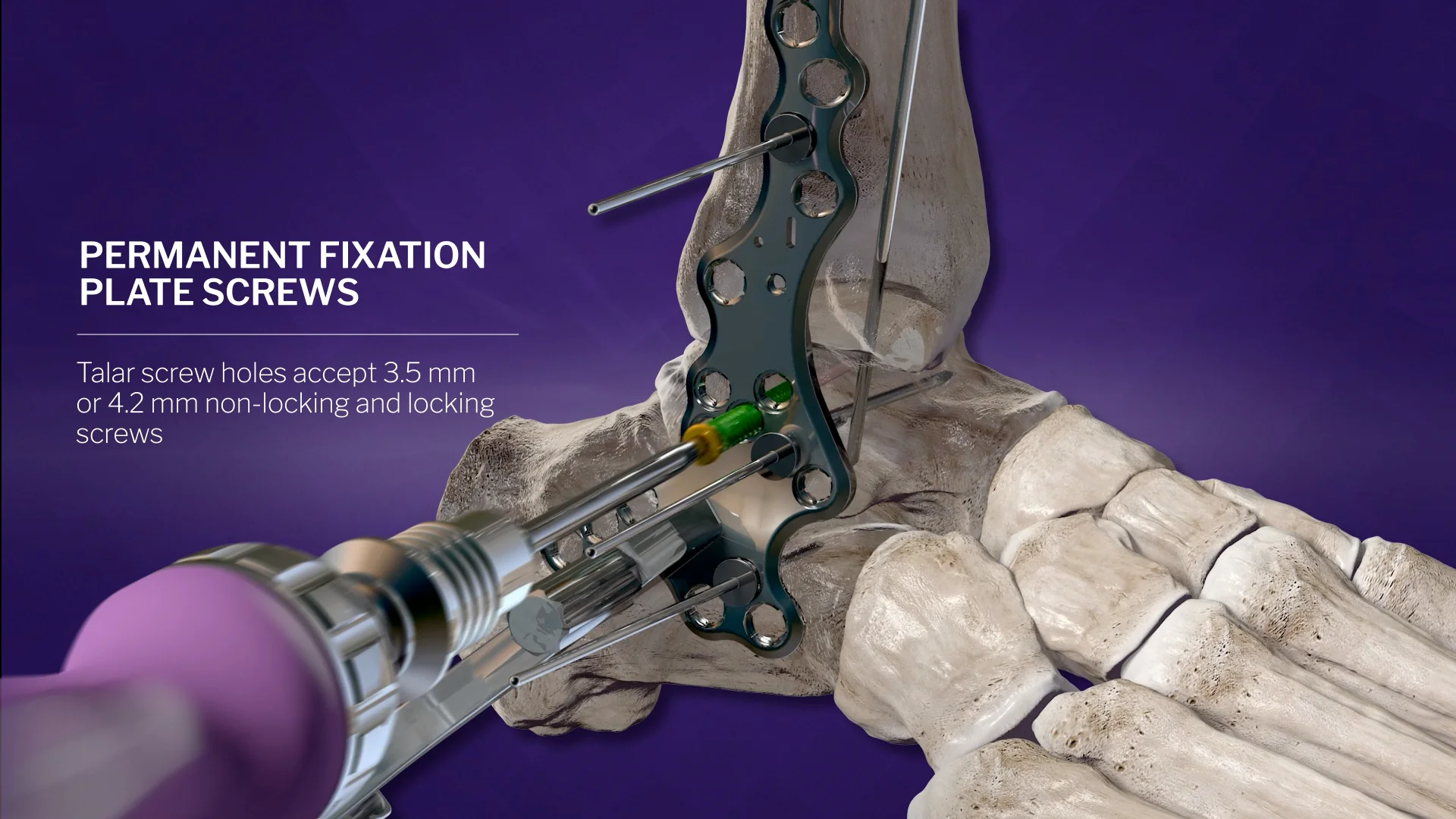 Animations – Paragon 28